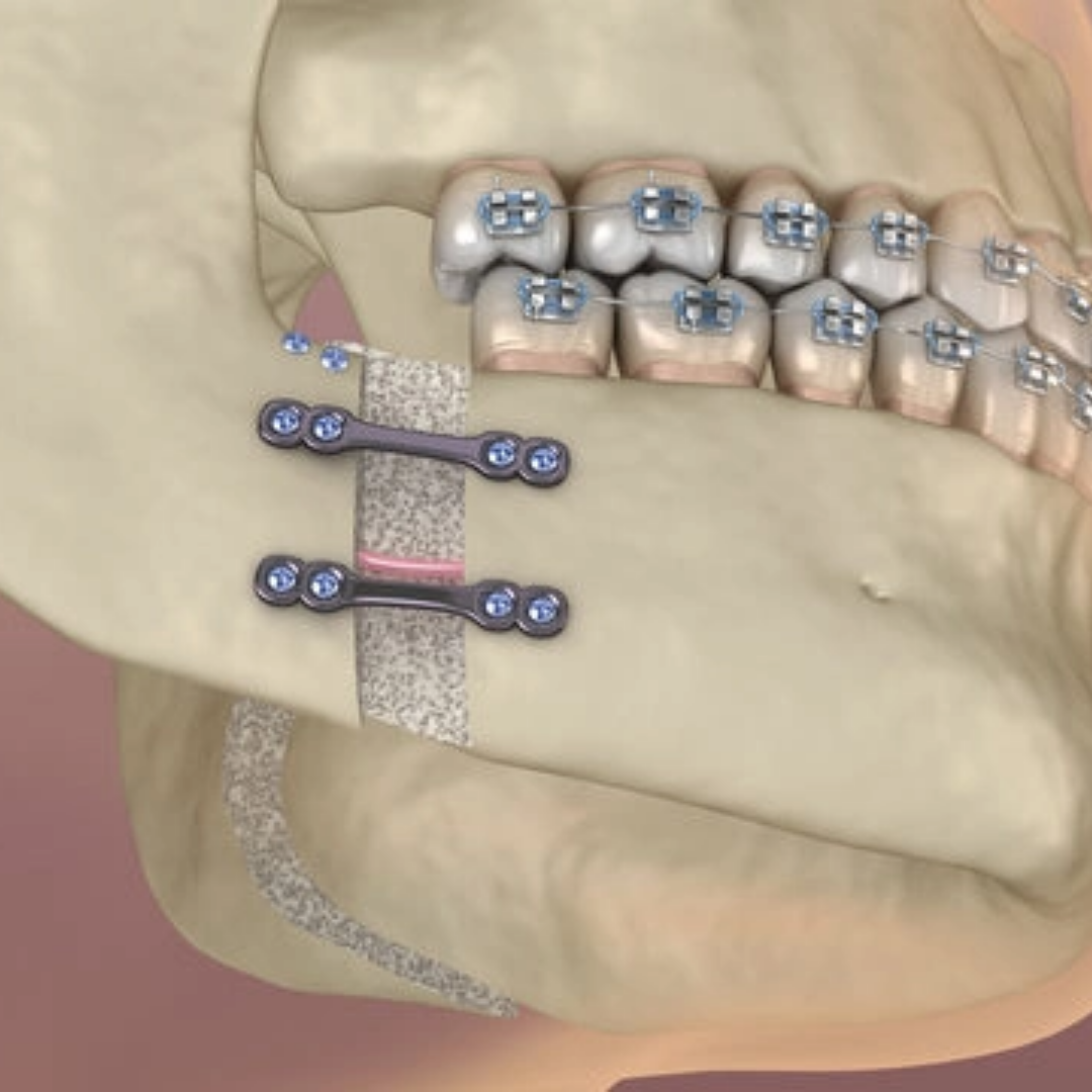 Orthognathic treatment cases