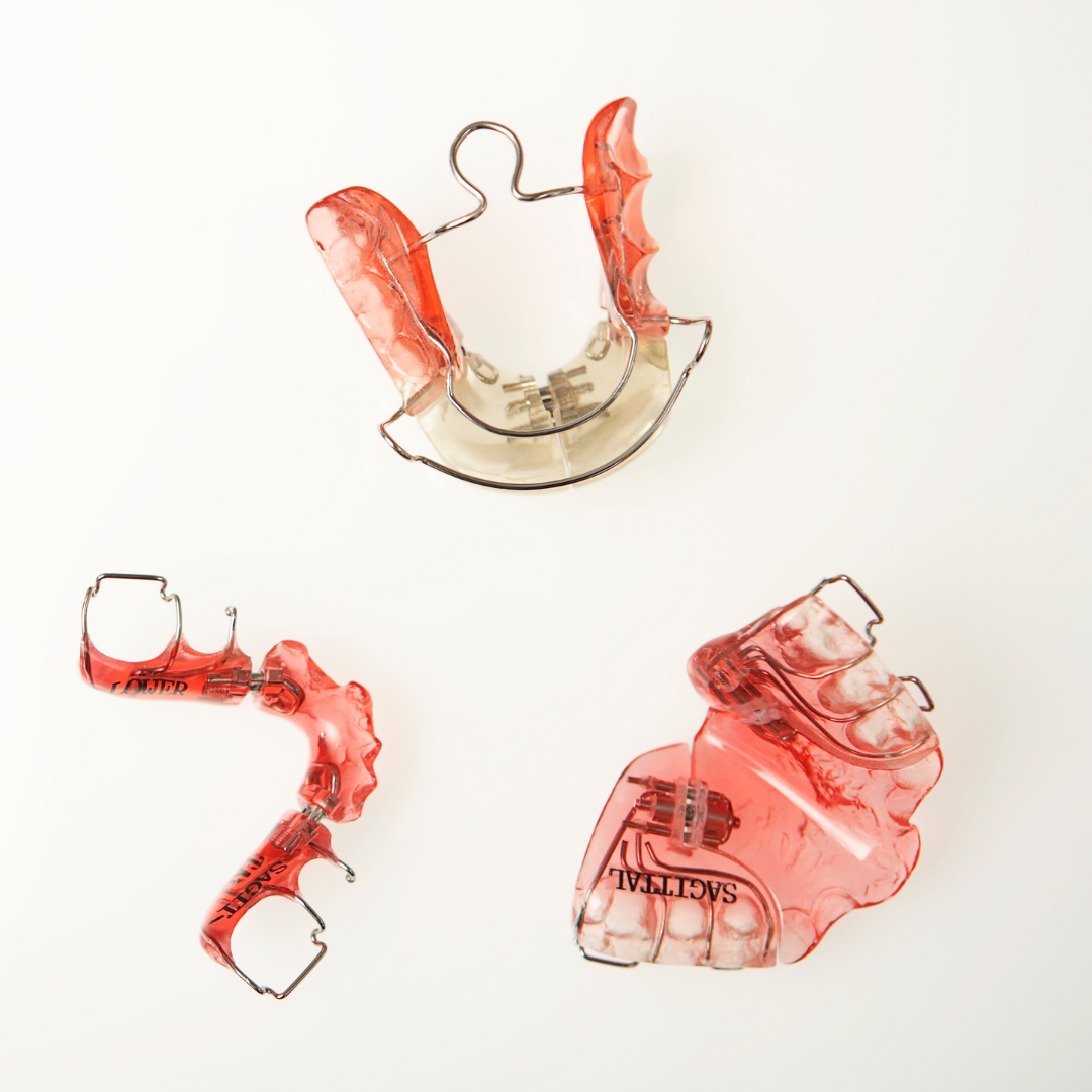 Retainers after orthodontic treatment